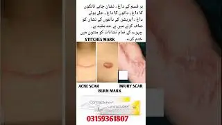 #contractubex gel#for face & skin#best for#acne scar#burn mark#injury mark#stitches Mark#pimples#💝💝💝