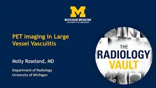 PET for Large Vessel Vasculitis