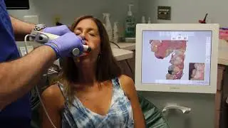 3Shape Dental Scanner Demonstration - Dr. David Wohl