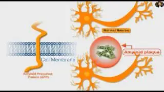Amyloid Precursor Protein APP, Alzheime  and Gamma secretase