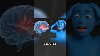 Brain Freeze Explained A Visual Guide Short