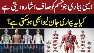 @Ta'aseen Homeopathic Clinic کیا یہ بیمار ی جان لیوابھی ہو سکتی ہے؟