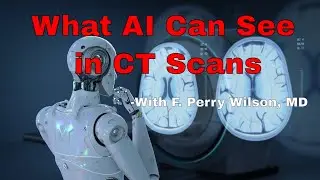 What AI Can See in CT Scans That Humans Can't