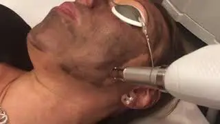 Hollywood JustNatural Carbon Facial in Timmins, Ontario