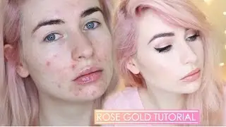 ROSE GOLD MAKEUP TUTORIAL | Full Face with acne