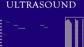 Gravis UltraSound (DOSBOX) - Super Mario Kart - Vanilla Lake (Beta)