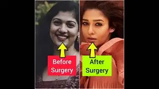 ഞെട്ടിപ്പോകും😱പ്ലാസ്റ്റിക് സർജറി ചെയ്ത് പണിപാളിയ മലയാള നടിമാർ🤥Plastic Surgery of Malayalam actre👃