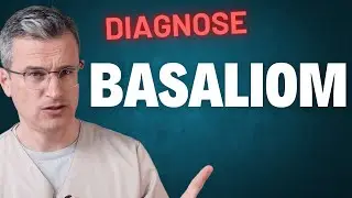 Hautkrebs: Was bedeutet die Diagnose Basaliom? 🧐🌞