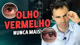 Olho Vermelho Nunca Mais! Causas e Como Resolver de Maneira Rápida a vermelhidão nos olhos.
