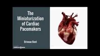 Miniaturization of Cardiac Pacemakers