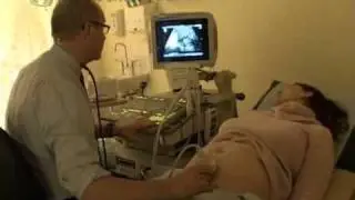 Pre-eclampsia