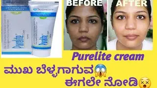 Purelite cream information in kannada|Uses|side effects| @healthcare595 #viral #skincareroutine