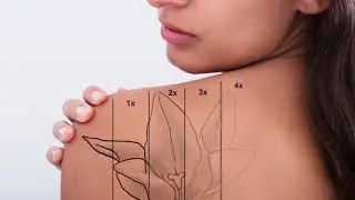 How To Speed Up Tattoo Removal And Fading