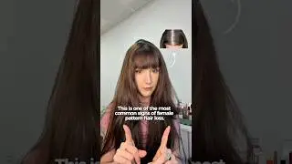 3 signs of female pattern hair loss you can&rsquo;t ignore 💆🏻&zwj;♀️✨ #femalepatternhairloss