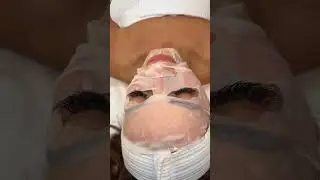 Derma /Chemical Peel ￼Facial ￼ #dermaplane  #dermaplaningfacial #chemicalpeel