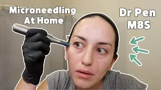 1st At Home Microneedling Session for Acne Scars with the Dr. Pen M8S