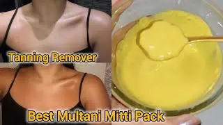 &ldquo;Summer Skin Care at Home 🌿 | Multani Mitti Face Pack for Tan Removal & Glow&rdquo;