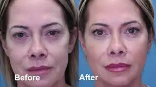 Dr. Daniel Man Board Certified Plastic Surgeon