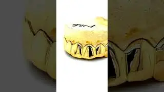 8pc 18k Gold Top Grillz in Seattle | Seattle Gold Grills