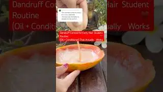 Dandruff Control for Curly Hair | Student Routine (Oil + Conditioner) That Actually Works #dandruff