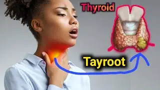 Qanjirka  dhuunta ee Tayroot ( Thyroid gland) Calaamadaha lagu garto iyo daawada ugu fiican