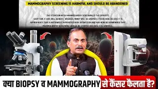 Mammography Kaise hoti hai? | Mammography &  Biopsy Side Effects | Acharya Manish ji | HIIMS