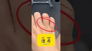 Do you have eczema？ #chineselanguage #dailychinese #freemandarinchinese
