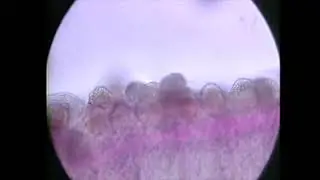 Trichophrya - parasite diseases in trout - signs, identification, treatment