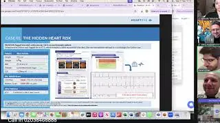 Dr Noon Talk #eyecareprofessionals #optometry  #ai #cardiologycare