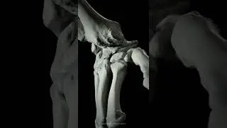 Capitate centered diagonal movement of the wrist