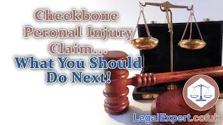 Cheekbone Personal Injury Claim &ndash; What We Think You Should Do Next! 2021 UK
