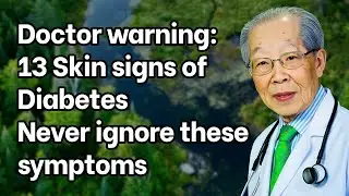 13 Skin signs of diabetes. Never ignore these SYMPTOMS