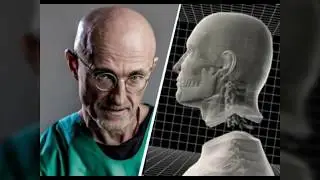 World's First Human Head Transplant A Success | Claims Controversial Scientist Sergio Canavero