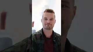 9 hours 4700 Grafts of Painless Hair Restoration 🧑&zwj;🦲 🧑&zwj;🦱💉