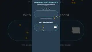 Tap Here if Your Hearing Aids Aren&rsquo;t Working as Well as They Should