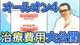 【オールオン4】治療費用を歯科院長が徹底解説！【インプラント】