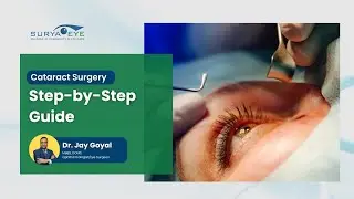 Cataract Surgery Steps Explained by Dr. Jay Goyal &ndash; Safe, Painless & Quick Procedure