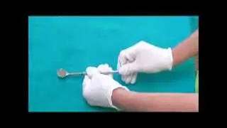 Nu-Bird Dental Mirror coin removal1