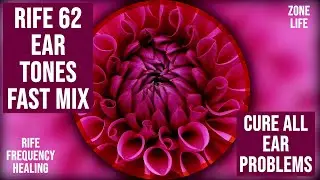 Quick Ear Cure : 62 Ear Rife Tones : Outer, Middle, Inner Ear Infection, Vertigo, Tinnitus
