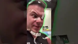 When Biting Your Nails Goes Too Far
