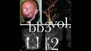 b.b.3 - give in