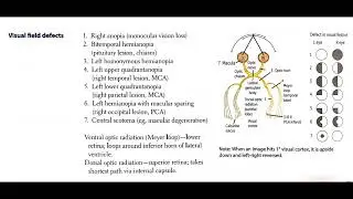 Visual Field Defects Explained (In Hindi Podcast) #medicalpodcast #neuroanatomy #ophthalmology