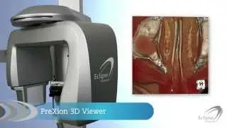 Prexion3D Viewer Software