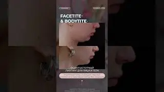 Face/Body Tite &ndash; радиочастотный лифтинг - эффект за 1 процедуру 🔥 #косметологиямосква