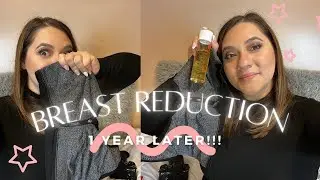 1 Year Breast Reduction Update : Scars, Recovery, Sizing, Regrets + More