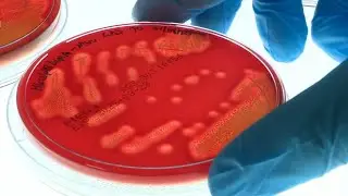 Nipah virus prompts heightened border security in Asia as two cases detected in India