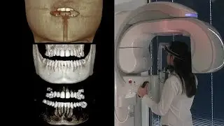 Cone Beam Cat Scan at Glo Modern Dentistry