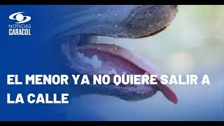 Pitbull mordió a un niño de 7 años: todo quedó grabado