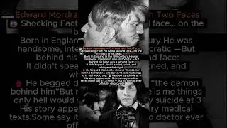 Edward Mordrake &mdash; The Man with Two Faces #facts #new #history