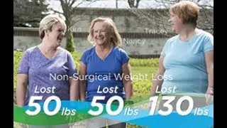 Kim, Nancy & Tracey's Story: Weight Management Solutions | Mercy Health